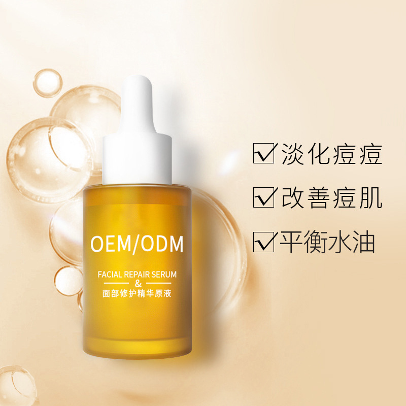 绥化市_祛痘精华原液OEM